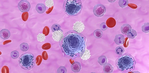 aml-cells-illustration-500x245.jpg