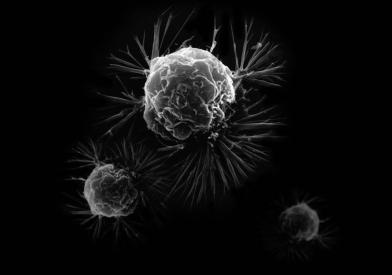 Breast Cancer Cells